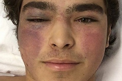 Pedro Piquet segue internado em Goiânia após forte acidente