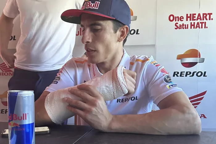Marc Márquez, Respol Honda con un vendaje en su brazo 