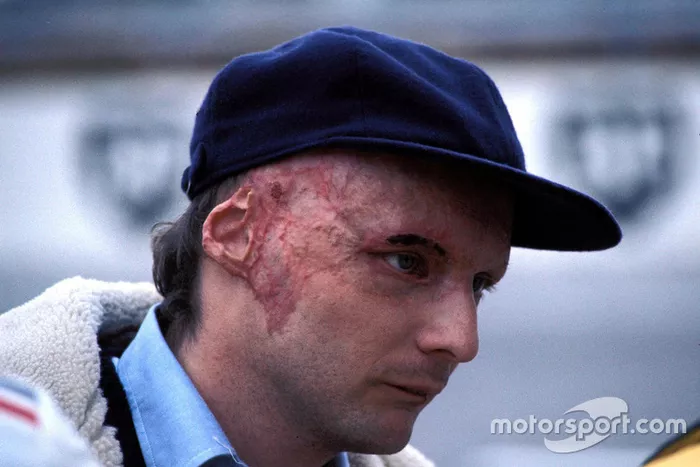 Niki Lauda, Ferrari