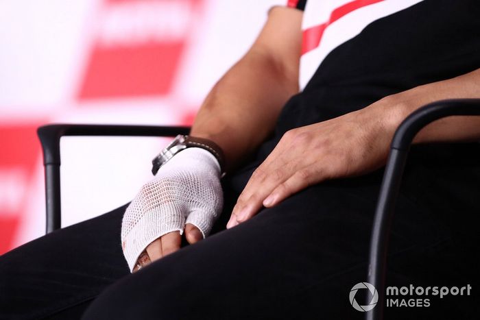 La mano lesionada Takaaki Nakagami, equipo LCR Honda
